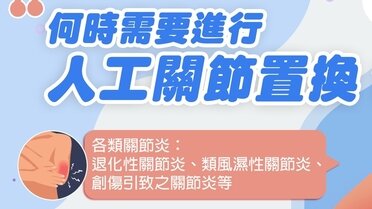 何時需要進行人工關節置換？