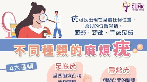 皮膚疣 (Only available in Chinese)