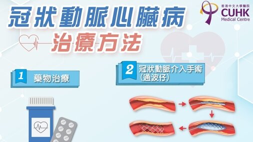 冠狀動脈心臟病治療方法 (Only available in Chinese)