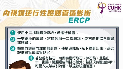 膽結石與 ERCP (Only available in Chinese)