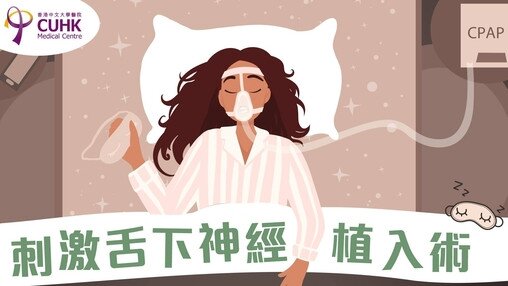 刺激舌下神經植入術 (Only available in Chinese)