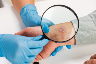 Image of a doctor checking patient skin condition