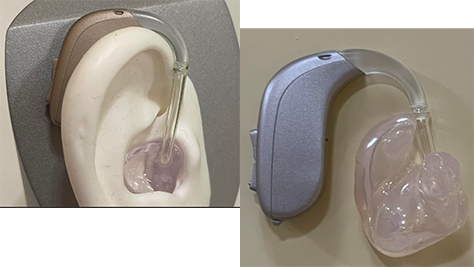 Image of hearing aids 1